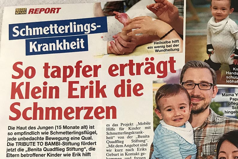 Mobile Hilfe für Kinder mit Schmetterlingskrankheit